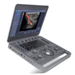 SonoScape X5 Portable Ultrasound Machine - Enhanced Imaging Efficiency