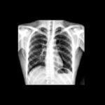 DR X-RAY WIRELESS - Cutting-edge Flat Panel Detector for Superior Imaging - Image 8