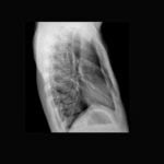 DR X-RAY WIRELESS - Cutting-edge Flat Panel Detector for Superior Imaging - Image 9