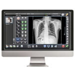 DR X-RAY WIRELESS - Cutting-edge Flat Panel Detector for Superior Imaging - Image 7